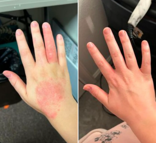 Dermatitis Control & Healthy Skin Cream - Relieves Itching, Redness & Flaking 50ml photo review
